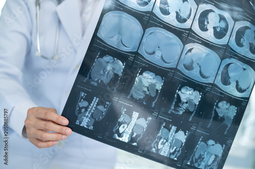Cuadro en lienzo doctor radiologic looks abdomen abdominal x-ray image film shows liver, colon,spleen, small intestine, bladder