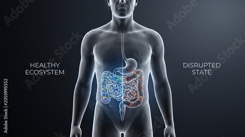 Abdominal Silhouette Gut Microbiome States 3D Precision Medicine