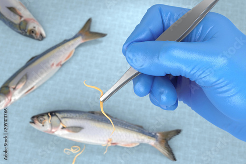 Doctor wearing gloves holding tweezers with Anisakis. Background with fish infected with Anisakis.