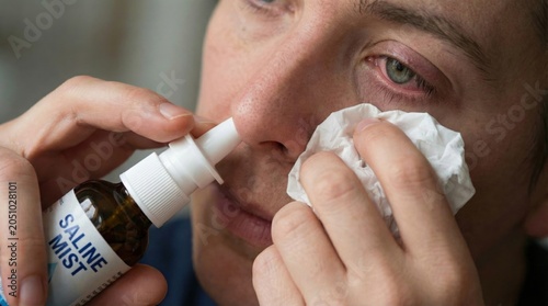 Close-up, woman with red eyes using saline mist and tissue to relieve nasal discomfort be illness