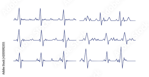 Photos Electrocardiogram Readings: A collection of electrocardiogram (ECG) readings showcasing variations in heart rhythm and electrical activity, displayed as a series of blue lines on a white background