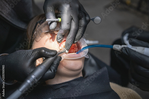 Schilderij op canvas Dentist hands in black gloves performing a detailed dental procedure on a patien