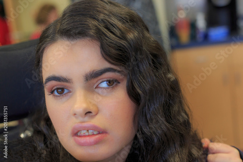 Girl with Tuberous Sclerosis learning at school