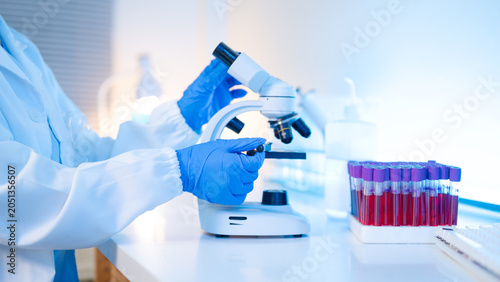 Fotografía Laboratory Scientist Examining Slide Under Microscope with Blood Sample Test Tub