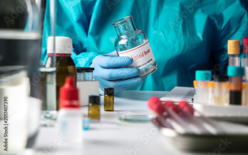 Εκτύπωση καμβά A scientist holds a test vial containing a typhoid fever sample in a laboratory;