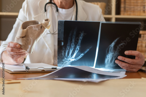 Doctor wearing a lab coat and stethoscope is carefully examining x-rays of a hand and wrist, while holding a beige medical wrist brace, discussing a bone fracture or injury