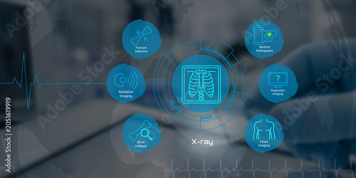 Bild auf Leinwand Modern medical xray technology applications for fracture detection chest imaging