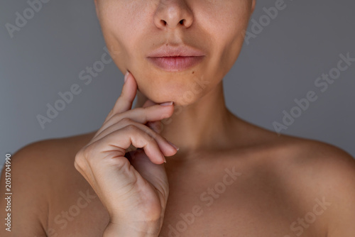 Schilderij op canvas Close up of young woman's lower face showing sculpted jawline and slimmer cheeks after buccal fat removal surgery