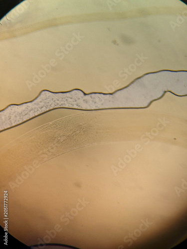 Photos Trichuris trichiura Whipworm Posterior End Showing Copulatory Spicule and Coiled