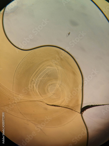 Obraz na plátně Trichuris trichiura Whipworm Posterior End Showing Copulatory Spicule and Coiled