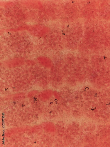 Foto Hymenolepis nana Strobila Segments Showing Multiple Proglottids and Internal Str