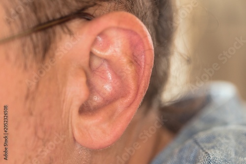 A close-up photograph of a man's ear, showing a detailed view of the outer ear structure.