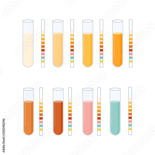 Urinal test kit set of urine sample cup and urinalysis reagent strips for kidney exam, urinary tract infection and cystitis diagnostics. Ketone and PH rapid testing. Medical vector illustration.