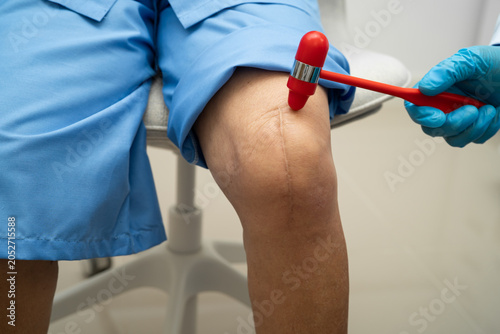 Bild auf Leinwand Asian doctor knock on knee reflex nerve for check and treatment senior patient in hospital