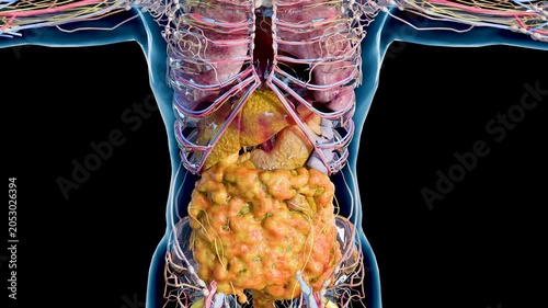 Progressive Accumulation of Visceral Fat and Fatty Liver Disease, Metabolic Syndrome and Internal Fat Gain, Liver and Abdominal Fat Progression, Advanced Steatosis and Visceral Obesity, 3d render