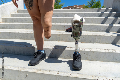 фотографія Person with amputated leg and prosthetic limb featuring camouflage design standi