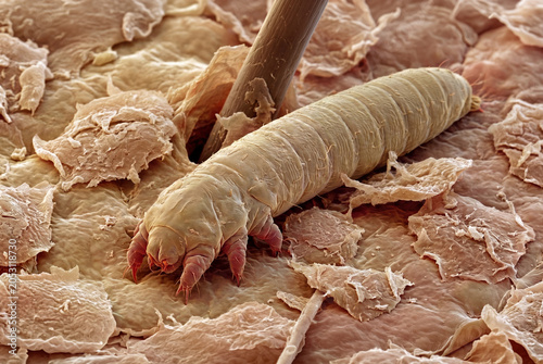 A Demodex hair follicle mite on human skin surface