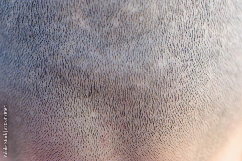 Bild auf Leinwand Rear view of bald woman head