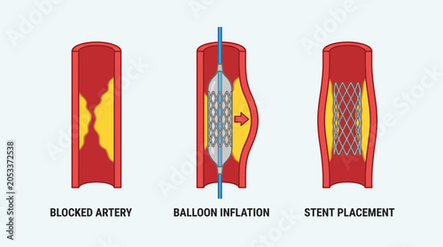Foto Halitosis Oral Malodor Sources Diagram