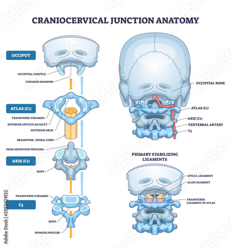 Tableau sur toile Craniocervical junction anatomy illustrates relationships of occiput, atlas (C1)