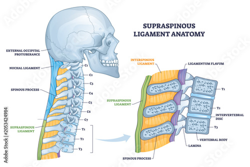 Canvastavla Supraspinous ligament anatomy brief depicts the ligament running along spinous p