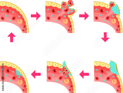 Foto Homostasis and Vascular Repair Process:Platelet Adhesion, Aggregation and Blood