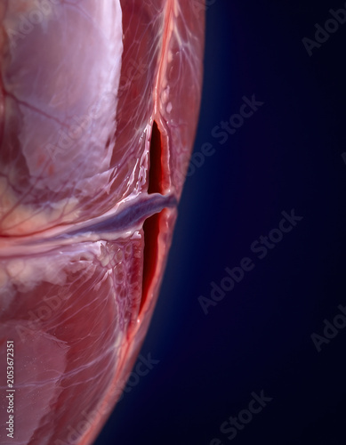 Patent Foramen Ovale Interatrial Septum Medical Macro
