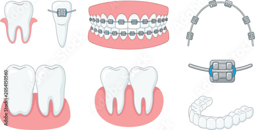 Orthodontic dental care vector set featuring teeth with metal braces clear aligners brackets wires human jaws and gums for dentistry and medical graphic designs