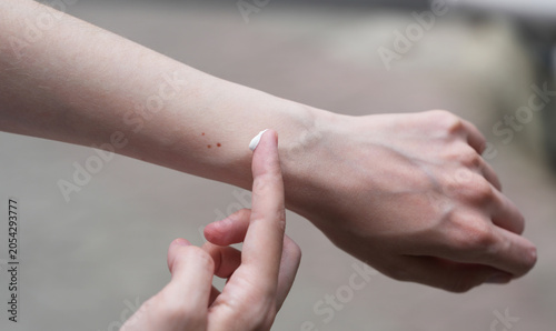Foto closeup of hands applying sunscreen protection on birthmarks on the arm, neutral
