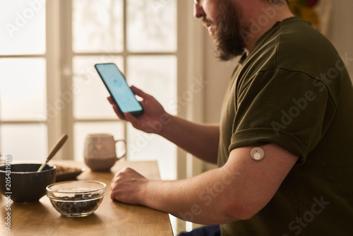 Fényképezés Young man checking glucose app on smartphone while wearing continuous monitor at home, managing diabetes care