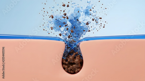 Blue cleansing liquid flushing dirt and impurity out of clogged skin pore