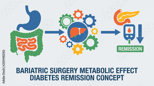 Valokuva Bariatric Surgery Metabolic Effect Diabetes Remission Concept
