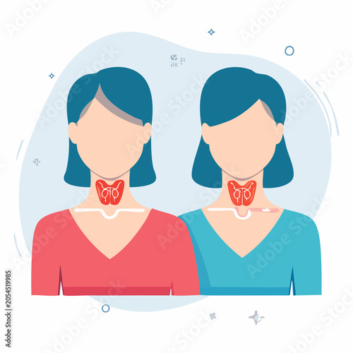Illustration of Two Women with Thyroid Glands Highlighted