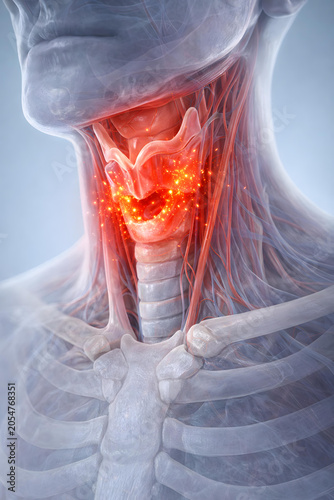 Thyroid gland neck anatomy inflammation medical endocrine throat thyroid gland neck anatomy with inflamed tissue and glowing pain signal human