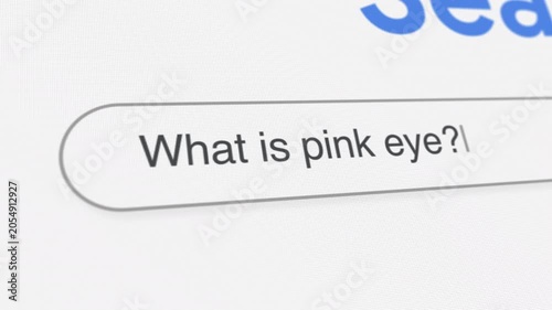 What is pink eye Search Prompt