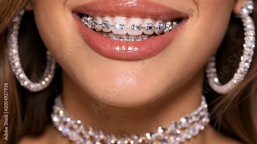 Smiling woman with dental braces and sparkling jewelry showcasing beauty confidence and care