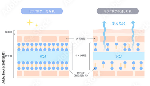 Foto セラミド不足による水分蒸散と保湿機能の違いを解説する肌断面図イラスト