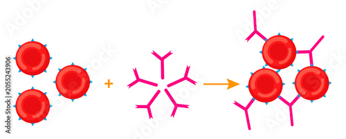 Tableau sur toile Diagram of red blood cell agglutination mechanism by antibodies