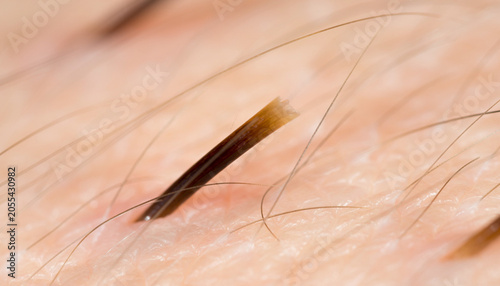 A lone hair rises like a dark mast on a pale skin sea, adrift in quiet unease