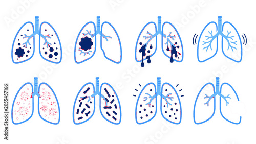 Foto Set of lung disease and respiratory condition vector icons