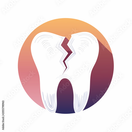 Cracked Tooth Illustration