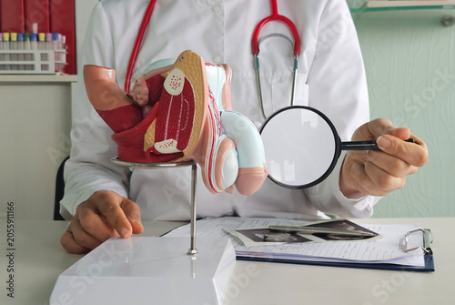Fotografie Doctors counseling patients with prostate cancer and using a penis model to show