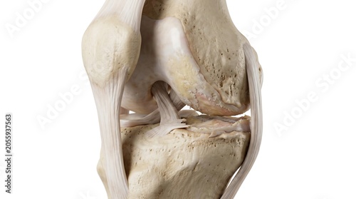 3D medical illustration of a human knee joint showing detailed anatomy with bone spurs and osteoarthritis symptoms on white background