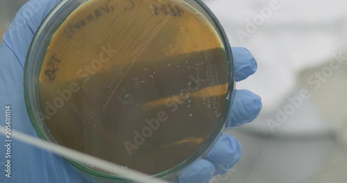 A scientist removes bacteria from a petri dish using a microbiological loop, close-up.