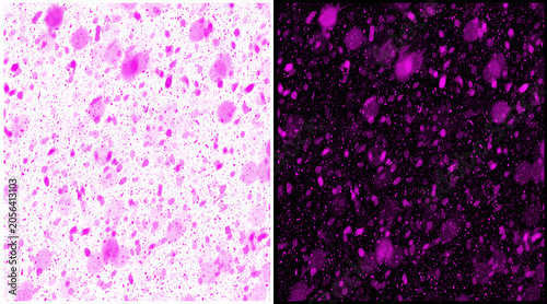 Foto Microscopic purple cells on white and black background, biological tissue sample