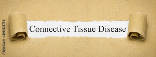 фотографія Connective Tissue Disease