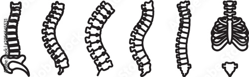 Foto Different human spine curvature conditions illustration