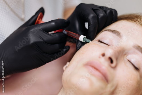 Fotografía Professional mesotherapy treatment applied to woman’s face in aesthetic medicine clinic