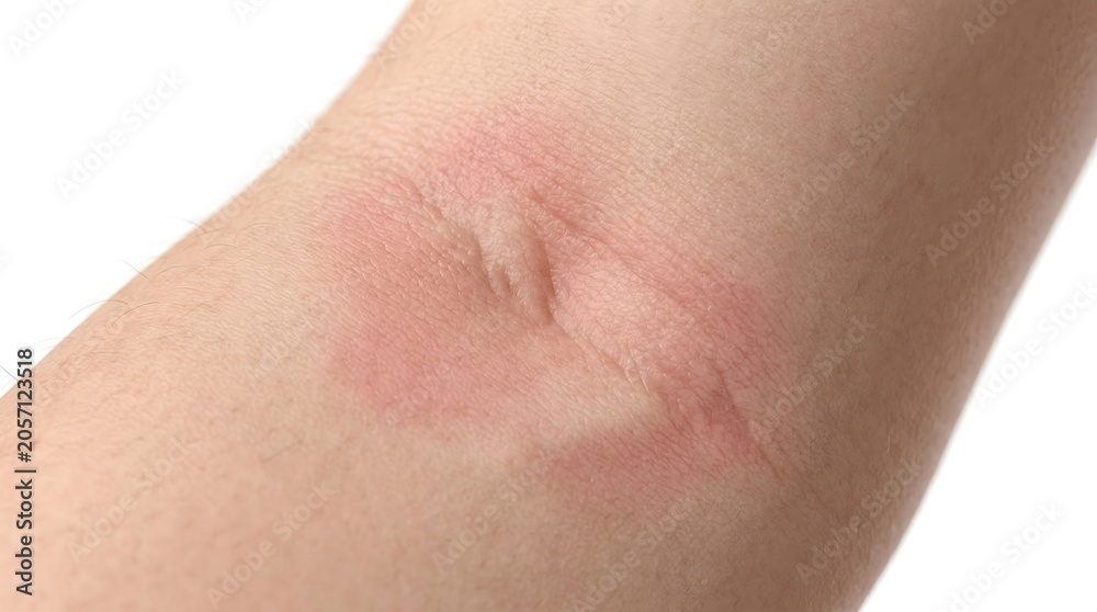Fototapeta premium Firefly_Gemini Flash_Professional dermatology macro v 84380 tMr