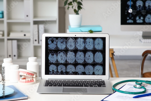 Medical brain scan on lapto...